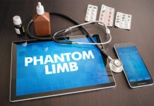 Phantom limb