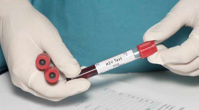 ตรวจเลือดหาเชื้อเอชไอวี