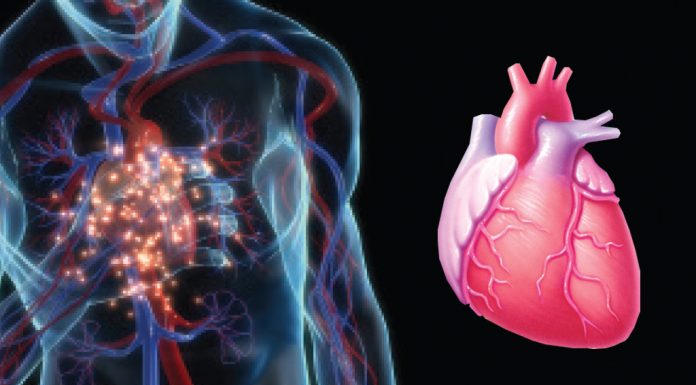 หัวใจขาดเลือด