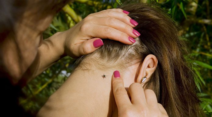 เห็บกัด