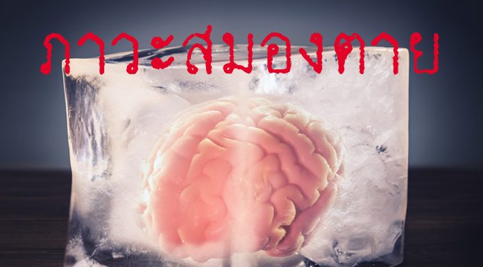 ภาวะสมองตาย